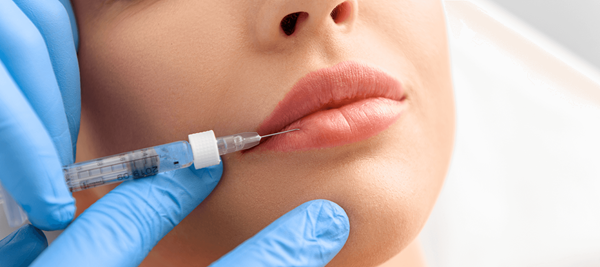 dermal-fillers-secret-aesthetics-in-orlando-fl