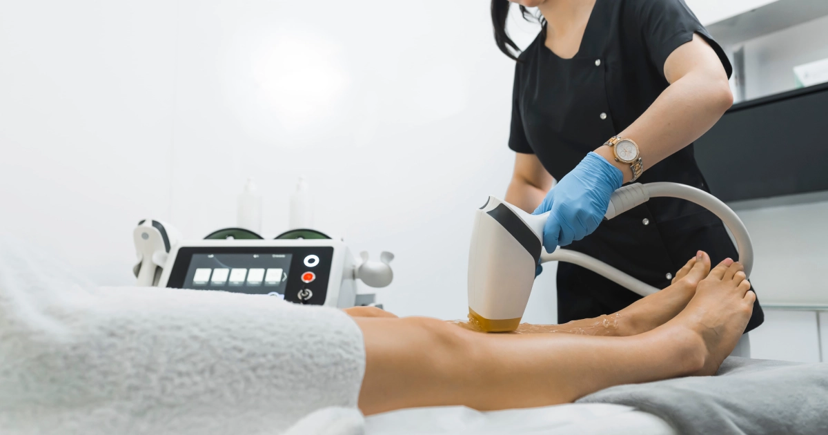 A professional performing laser hair removal on a client’s legs using a modern laser device in a clean clinic setting in Windermere
